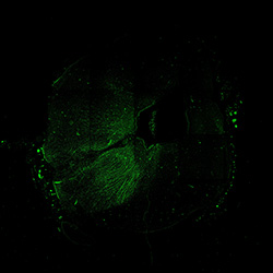 13PCW human midbrain